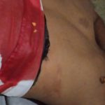 Tawuran Antar Pelajar Kembali Menelan Korban