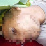 Naas! Kecelakaan Saat Bawa Kabur Motor Curian, Maling Motor Akhirnya Tewas di Cilebar Karawang