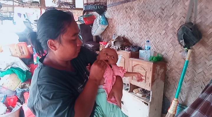 Bayi Stunting, Ditengah Ramainya Dana Hibah 10 Miliyar Oleh Pemkab Karawang