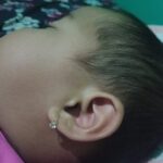 Daun Telinga Bayi Menyerupai Lapadz Allah