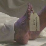 10 Orang Meninggal Dunia dan 4 Orang Masih di Rawat